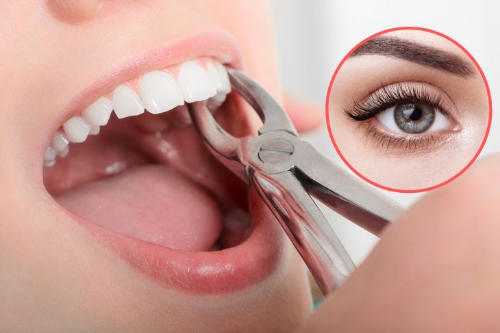 Debunking The Myth: Does Tooth Extraction Affect Eyesight?