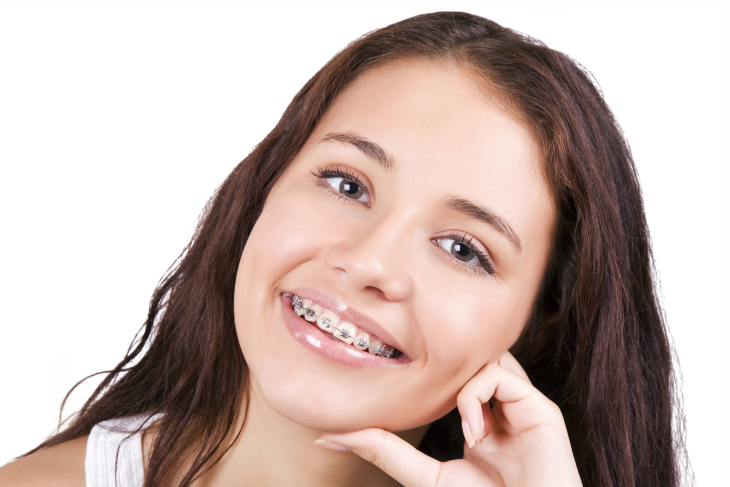 Tips For Keeping Your Teeth Healthy And Beautiful After Getting Braces Treatment